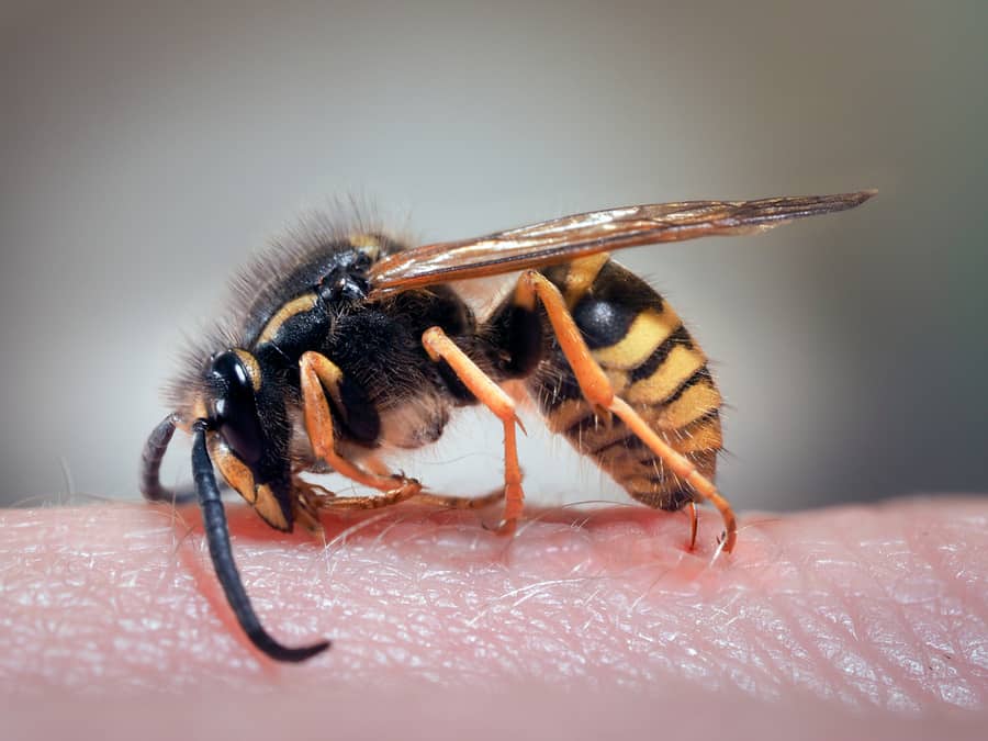 Treating A Wasp Sting